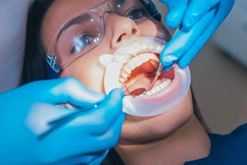 Endodoncia